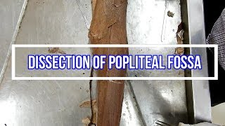 Popliteal Fossa Anatomy Quick amp Easy Mnemonics [upl. by Garwood]