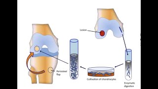 Knee Cartilage Regeneration [upl. by Yalhsa]