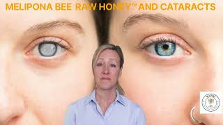 MELIPONA BEE RAW HONEY™ AND CATARACTS [upl. by Rehpitsirhc]