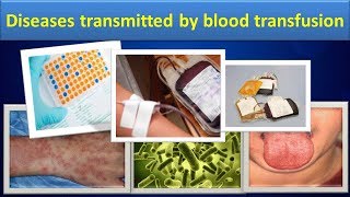 Diseases transmitted by blood transfusionClear over view [upl. by Parent]