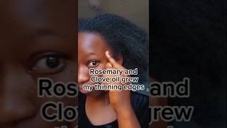 Rosemary and Clove oil for thinning and bald edges clovesforhairgrowth hairgrowth 4cnaturalhair [upl. by Yenor]