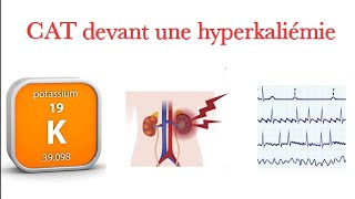 CAT devant hyperkaliémie [upl. by Spragens495]