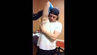 Pain in Elbow Baseball Player Kinesio Taping [upl. by Diogenes]