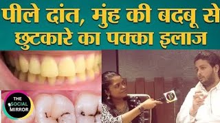 पीले दांत मुंह में बदबू चुटकी में गायब yellowteeth dentist [upl. by Groh258]