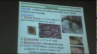 DrAzza Parasitology  Nematodes 6  Tissue Nematodes [upl. by Dreeda]