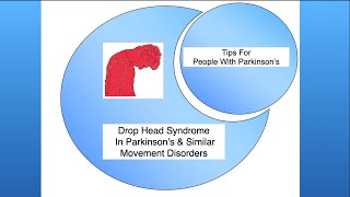 Drop Head Posture In Parkinsonism [upl. by Aihseyn]