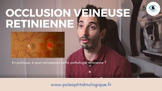 Occlusion veineuse rétinienne Pole ophtalmologique [upl. by Allister]