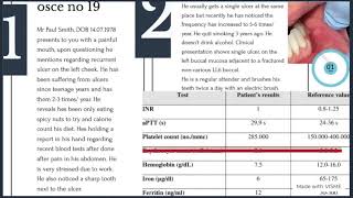 osce 19 dental clinical exams part 2 ORE MFDS MJDF LDS UK spoken [upl. by Philips]