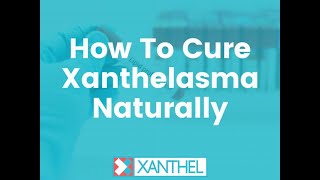 How To Cure Xanthelasma Naturally  Brought To You By XANTHEL ® Easy Xanthelasma Removal [upl. by Bum]