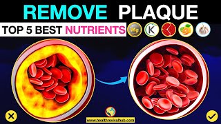 THE Nutrients to Remove Calcium Plaque from Arteries [upl. by Redfield]