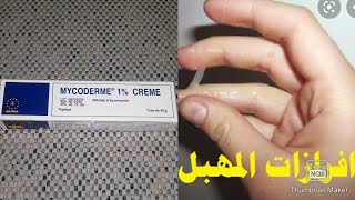 كريم mycoderm العلاج النهائي لحكة المهبل ومشاكل جلدية اخرى مع طريقة استعمال وداعا للافرازات المهبلية [upl. by Lilian]