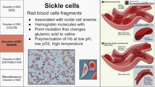 Red Blood Cell Morphological Abnormalities [upl. by Onitnelav607]