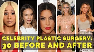 Celebrity Plastic Surgery 30 Before and After [upl. by Stevens]