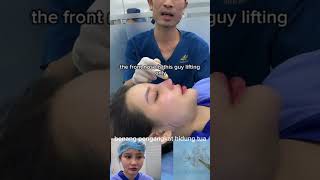 old nose lift thread xuhuongyoutube lamdep thongthainguyen fyp [upl. by Ihcekn220]