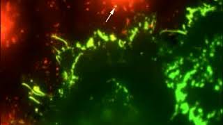 Nectin 4 is taken up by nectin 1expressing cells [upl. by Arnst689]