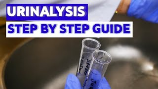 HOW TO DO URINALYSIS MEDICAL LABORATORY SCIENCE [upl. by Ennahoj]