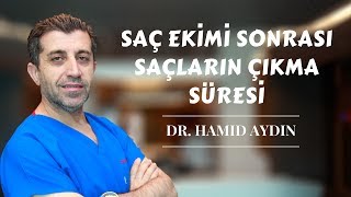 Donör bölgenin iyileşmesi ve saçların çıkma süresi  Dr Hamid AYDIN [upl. by Nalniuq]