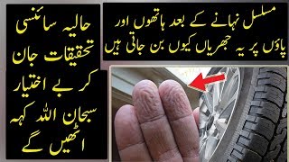 Why We Get WaterWrinkled Fingers And Feets  Urdu  Hindi [upl. by Jazmin382]