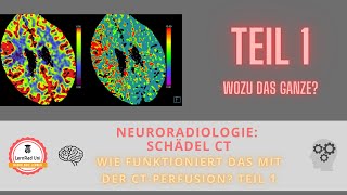 CT Perfusion des Hirnparenchyms  Teil 1 Wozu das Ganze [upl. by Ahsikram270]