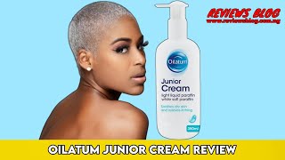 Oilatum Junior Cream Review You Need To Watch This Video [upl. by Aryad]