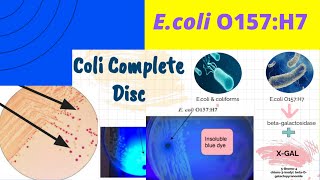 Ecoli O157H7 A Foodborne pathogenEnrichment amp IsolationEEBSMAC TSYEEMB and Coli complete Disc [upl. by Einahpet]