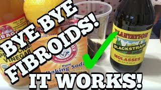 SHRINK FIBROIDS NATURALLY WITH THIS CONCOCTION  IT WORKS [upl. by Johannah]