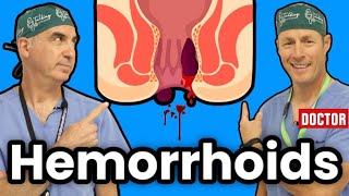 How To Get Rid Of Hemorrhoids [upl. by Sherj156]