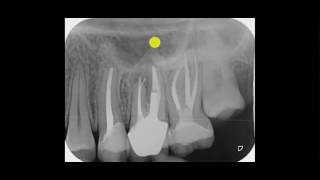 für Zahnärzte ein Röntgen kann täuschen [upl. by Ayim916]