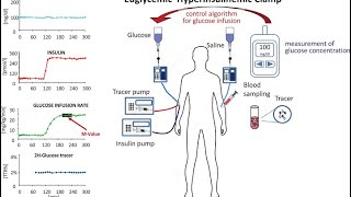 Why SGLT2 Inhibitors Cause Euglycemic DKA [upl. by Marena]