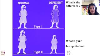 Week 2  Lecture 9  Hidden hunger and types of malnutrition [upl. by Roderich506]