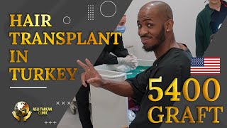 5400 Graft Hair Transplantation  Aslı Tarcan Clinic [upl. by Adamski]