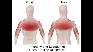 Distinguishing Types of Chest Pain [upl. by Daria999]