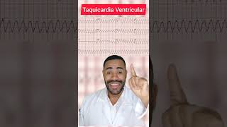 Taquicardia Ventricular ecg [upl. by Lanrev]