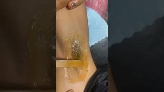 Waxing under arms hair removal howtowax underarmswaxing nepal beautyqueen parlour [upl. by Nomae]