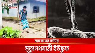 মরা সাপের কাঁটায় মৃত্যুপথযাত্রী ইউছুফ  DBC NEWS Special [upl. by Mendy]