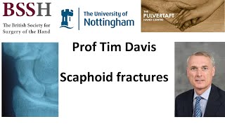 Scaphoid fractures by Prof Tim Davis [upl. by Chilt]