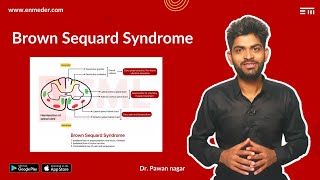 Brown Sequard Syndrome  Dr Pawan nagar [upl. by Ab207]