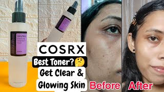 COSRXAHABHA Clarifying Treatment Toner Review💙Best Toner for Clear Skin✅ [upl. by Ettezil810]