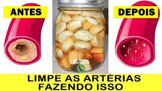 Esta Receita SUGA A GORDURA das Veias Igual Aspirador Suga Poeira [upl. by Mcwherter]