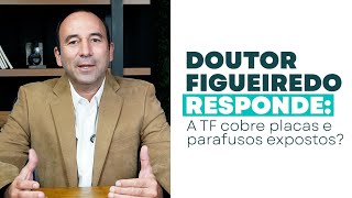 Doutor Figueiredo responde  A TF cobre placas e parafusos expostos tecnicadefigueiredo [upl. by Garda359]