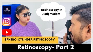 Retinoscopy Part 2  Static Retinoscopy for astigmatism  SpheroCylinder method [upl. by Kreiker]