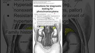 Indications for diagnostic testing for pheochromocytoma [upl. by Delija]