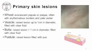 4 Primary and Secondary skin lesions [upl. by Atterrol]