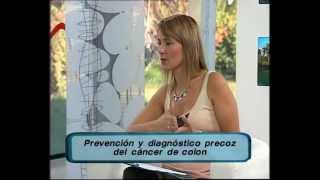 Fibrocolonoscopía para prevenir cáncer de colon [upl. by Aytac]