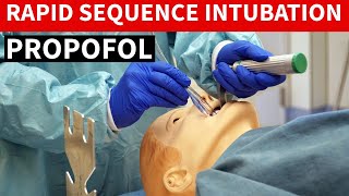 Propofol Diprivan Rapid Sequence Intubation [upl. by Hafeenah]