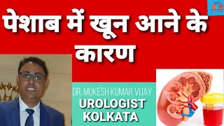 पेशाब में खून आने का कारण  blood in urine maleblood in urine causesblood in urine women in detail [upl. by Aivatco]