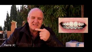 ORTHODONTIE par ALIGNER INVISALIGN ADULTE  SENIOR [upl. by Aninad]