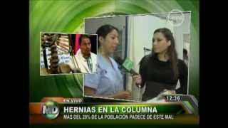 TRATAMIENTO HERNIA DISCAL Efectivo Seguro Elimina Dolor [upl. by Aniara762]