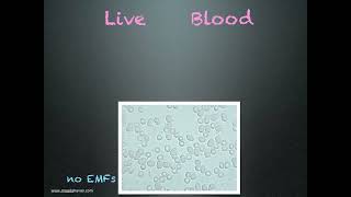 DR Magda Havas Live Blood and Electrosmog 5G 4G [upl. by Anassor]