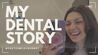 My Denture Story with Thats My Beauty before implants [upl. by Nauq]